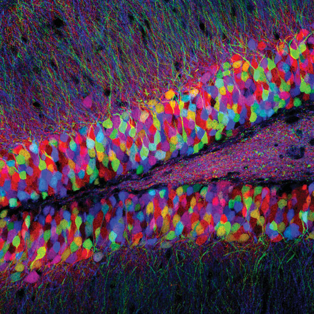 Brainbow images of mice show how the brain continues to rewire itself, grow new cells, and create new connections throughout life. [Harvard Medical]
